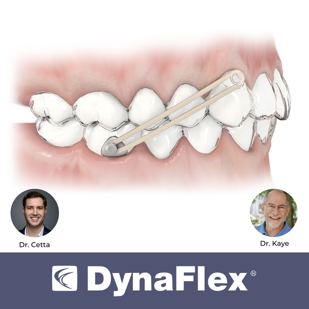Dr. Cetta & Dr. Kaye Precision Aligner ButtonsB
